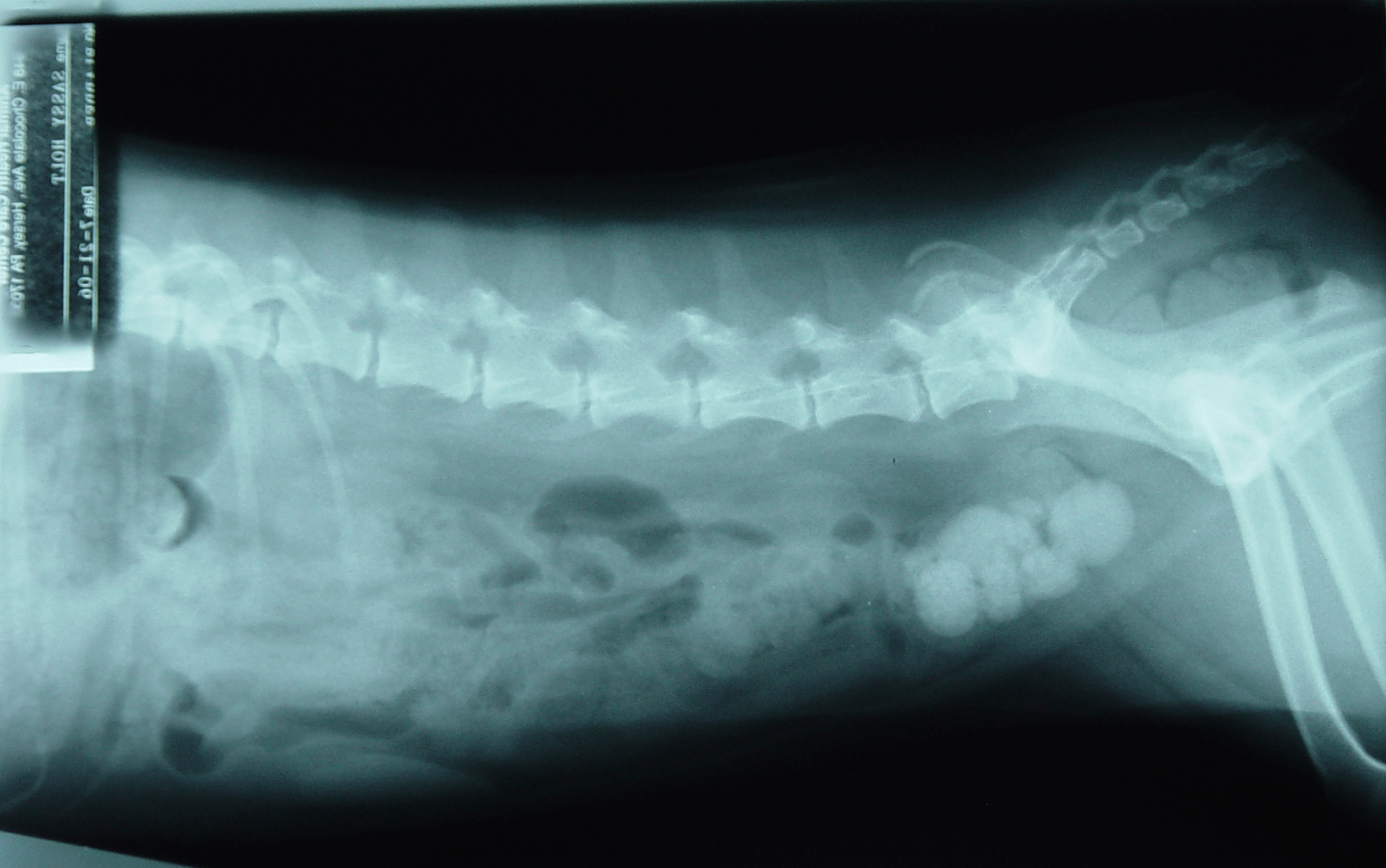 A radiograph of an abdomen with bladder stones
